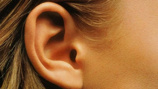 La "Suciedad" que Protege tus Oídos: Desmitificando la Cera