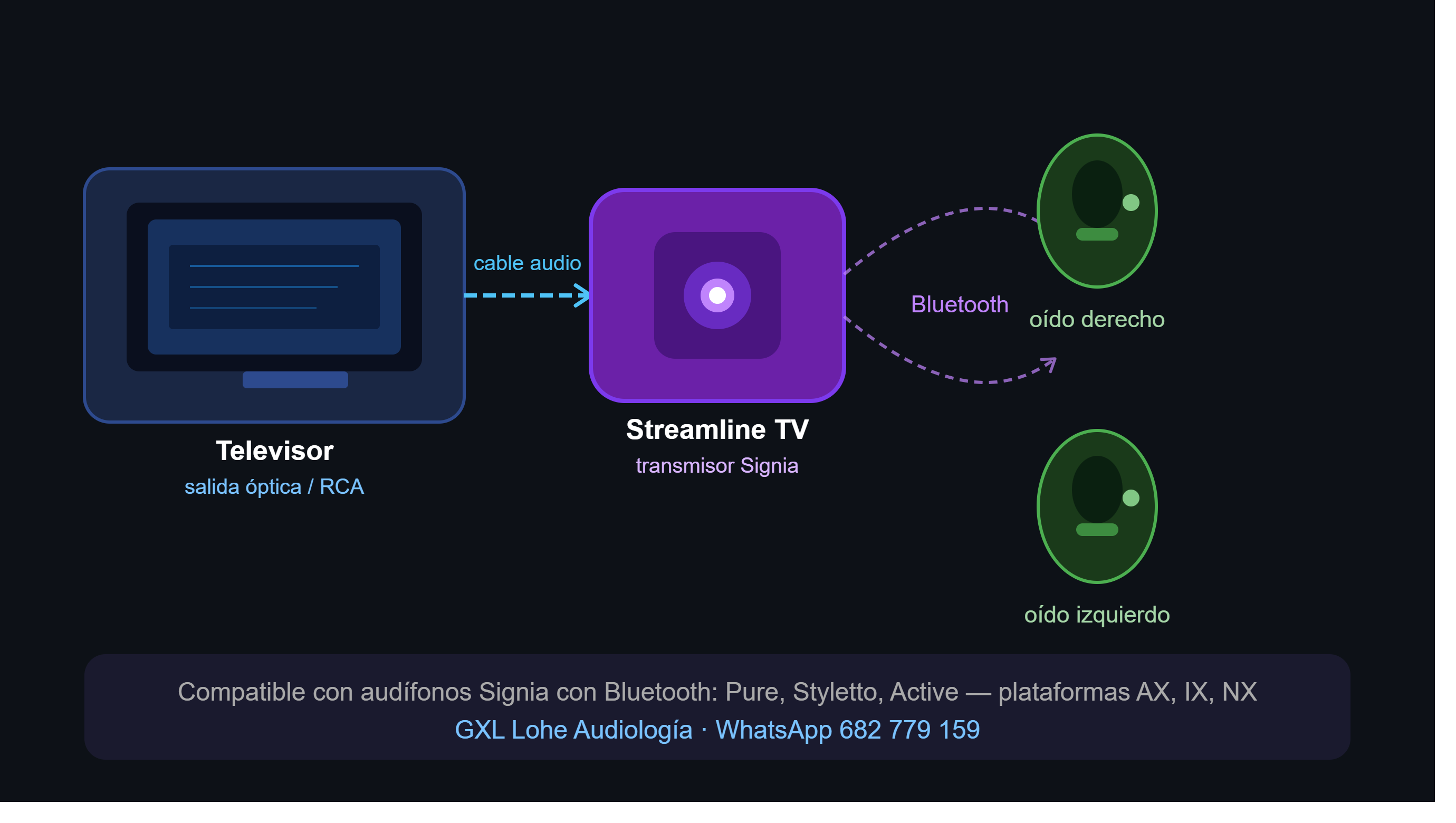 Signia Streamline TV: Qué es, Cómo Funciona y Para Qué Sirve