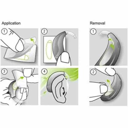 Adhesivos Stick’n Stay de Phonak